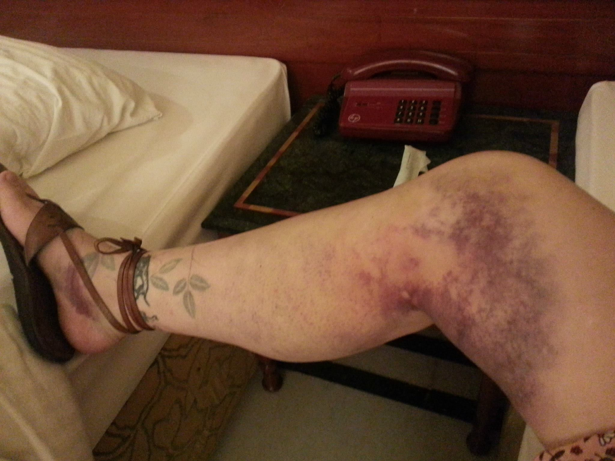 The leg, day one — it got significantly more impressive from here